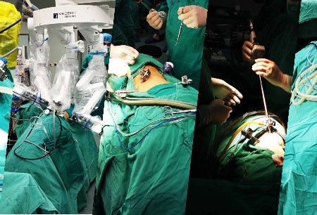 創(chuàng) “六連臺(tái)”紀(jì)錄！圖邁?機(jī)器人助力新疆自治區(qū)人民醫(yī)院成功完成首次六連臺(tái)機(jī)器人手術(shù)