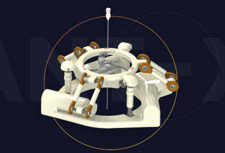 全球首款！ant-x?經(jīng)皮介入機(jī)器人獲FDA認(rèn)證